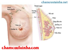 Thái cực quyền cải thiện chứng mất ngủ ở người mắc bệnh ung thư vú