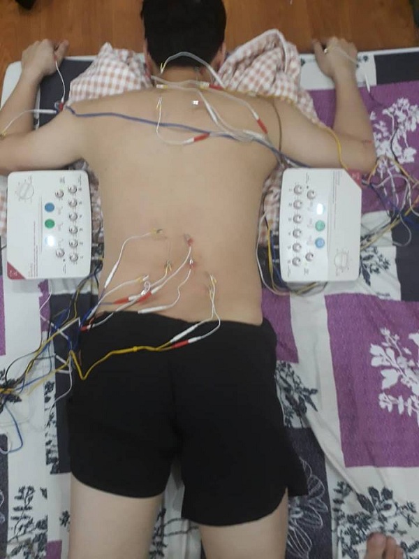 Dịch vụ xoa bóp bấm huyệt, Châm cứu tại nhà