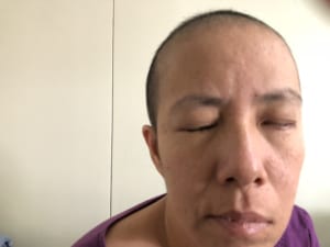 liệt mặt