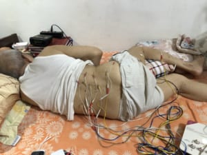 Châm cứu chữa thoát vị đĩa đệm mang lại hiệu quả cao