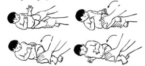 Phục hồi chức năng trẻ bại não