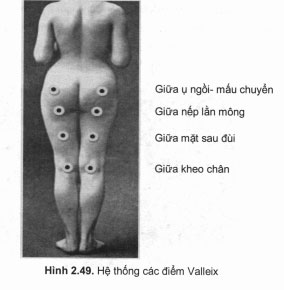 hệ thống điểm đau vallex