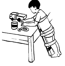 PHCN cho trẻ bại não
