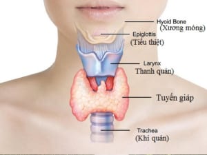 Bướu giáp trạng đơn thuần