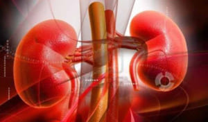 viêm cầu thận cấp