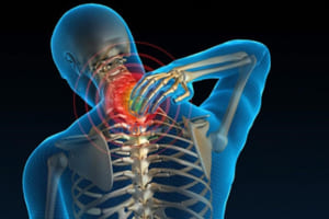 Thoát vị đĩa đệm cột sống cổ
