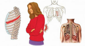Đau dây thần kinh liên sườn