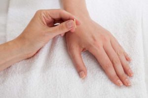 Châm huyệt hợp cốc trị tê tay