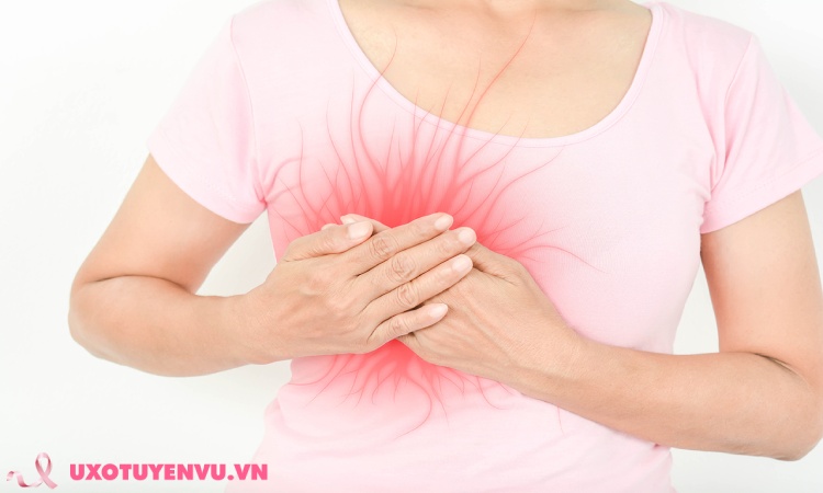 apxe tuyến vú